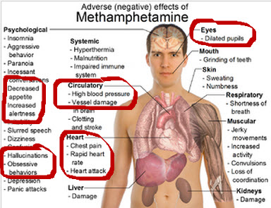 valium complications of asthma